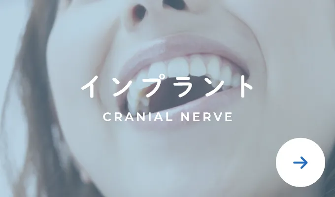 インプラント